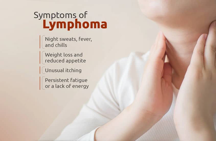 Lymphoma Symptoms: The signs of Lymphoma